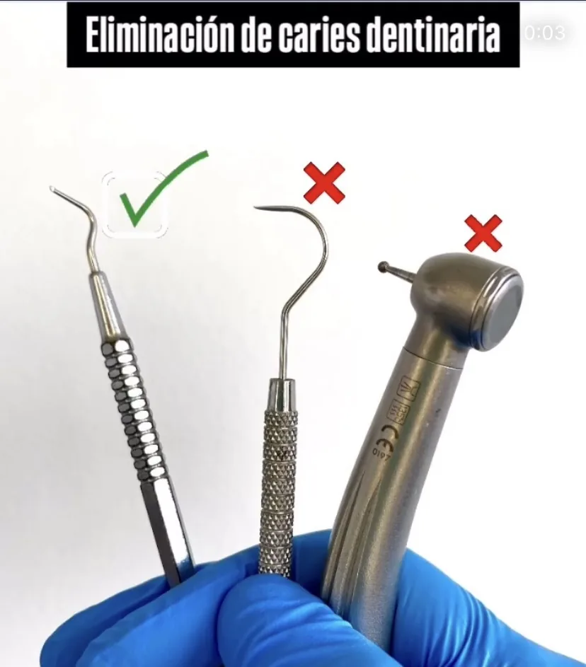Manejo no invasivo de caries dental